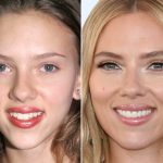 scarlett johansson before and after 3