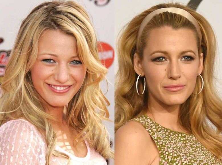Blake Lively Boob Job – Did The Actress Get A Plastic Surgery? - Follow News