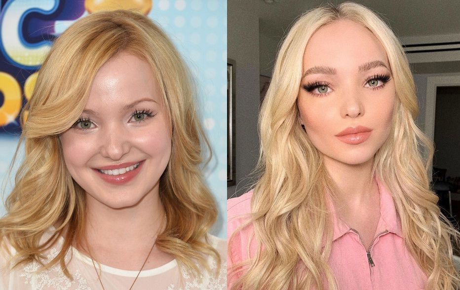 dove cameron before and after