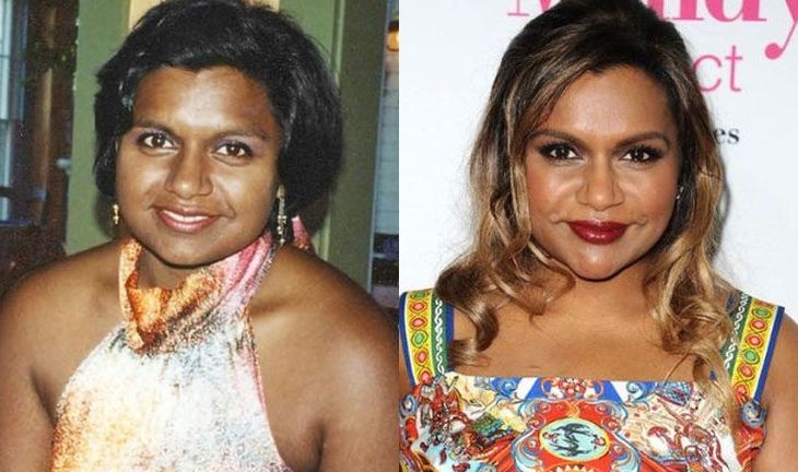 mindy kaling before and after plastic surgery