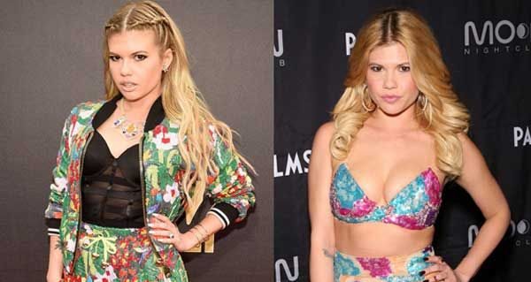 chanel west coast breast surgery