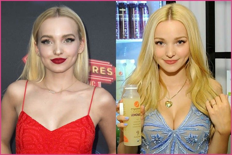 dove cameron before and after surgery