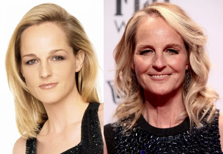 What Happened To Helen Hunt’s Face Plastic Surgery Rumors? Follow News