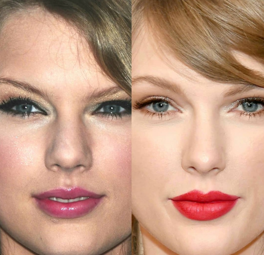 taylor swift before and after plastic surgery